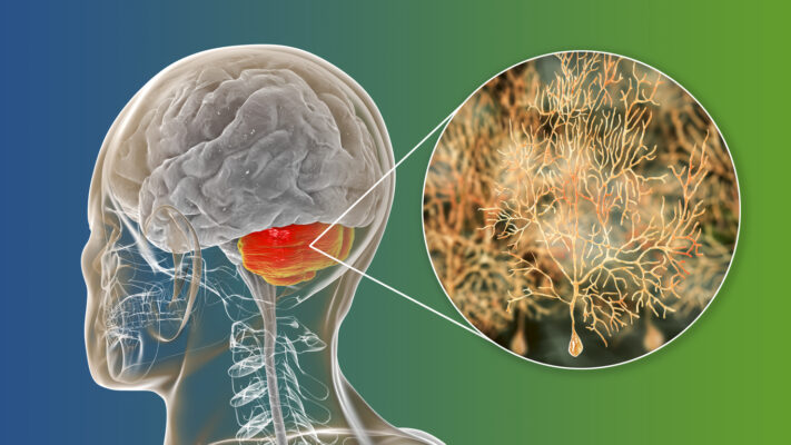 Human brain with highlighted cerebellum and close-up view of Purkinje neurons, one of the commonest types of cells in cerebellar cortex, 3D illustration