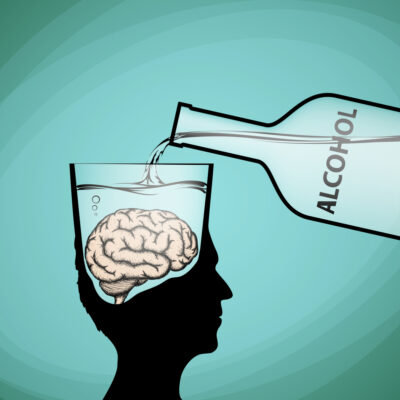 wet brain alcohol